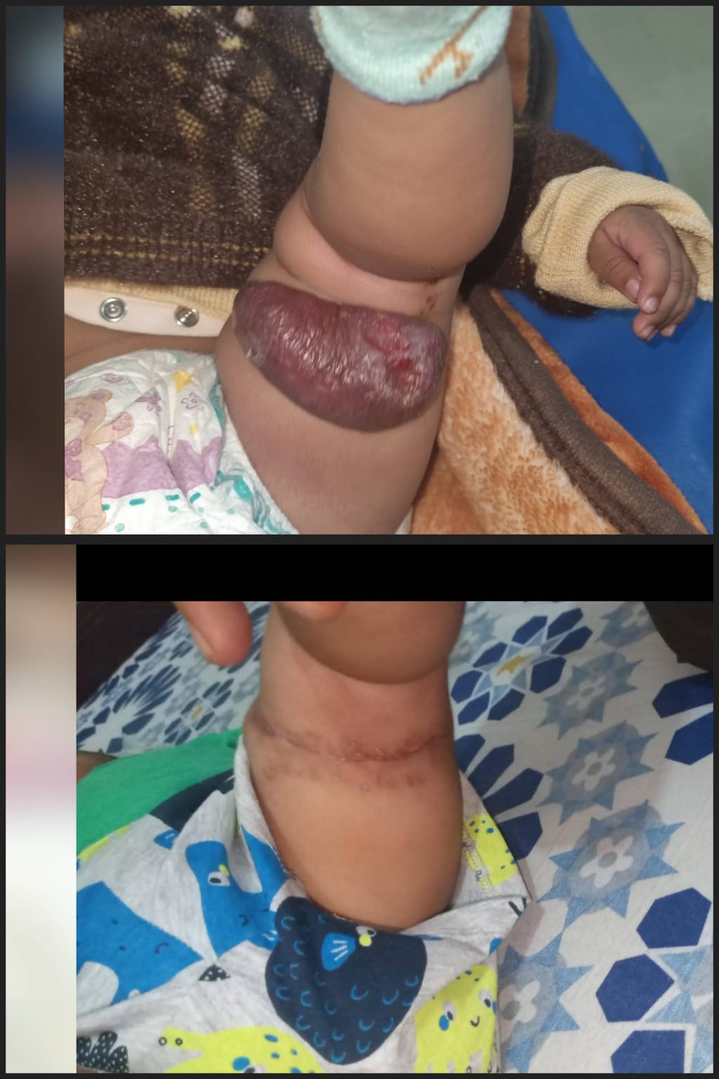 Before & After 10